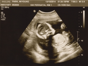 ultrasound 2014-12-10 12.jpg